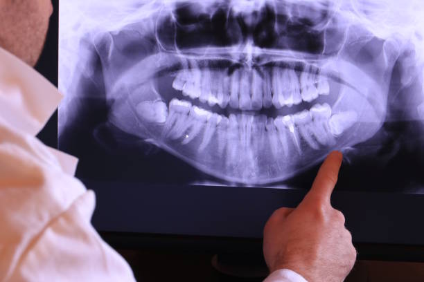 Best Emergency Root Canal Therapy in Merian, ID